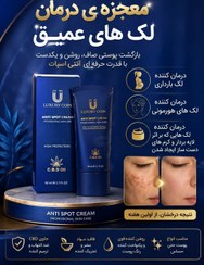 5 محصول موثر درمانی رفع لک و اکنه و جای جوش برند لاکچری کوین فرانسه مستقیم از نمایندگی ایران زمین