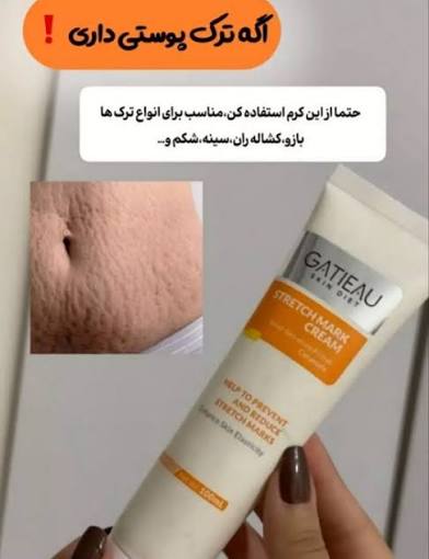 کرم رفع واریس وترک ایتالیایی گاتیو